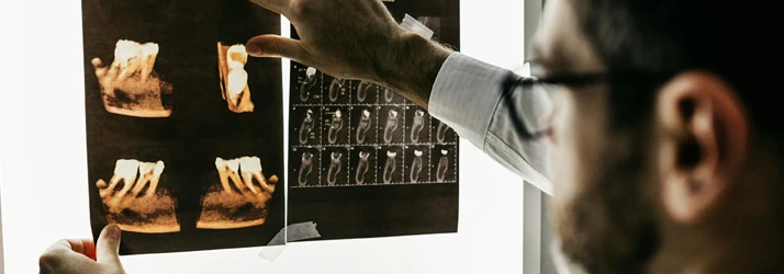 Pediatric Dentist Campbell CA Dental X-Rays Focused